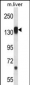 RPS6KC1 Antibody (N-term)